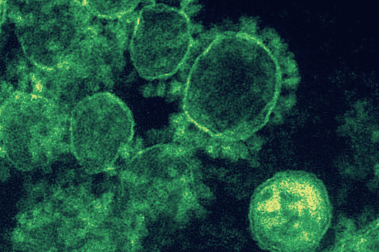 A microscopic view of green circular organisms representing infection – Viome Oral Health Intelligence Test